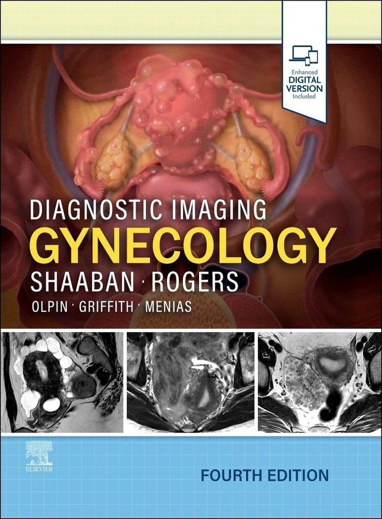 Diagnostic imaging:gynecology