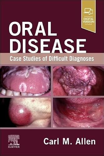 ORAL DISEASE:CASE STUDIES OF DIFFICULT DIAGNOSES
